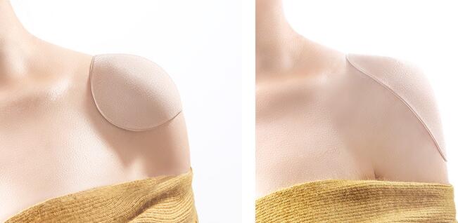 Importikaah shoulder pads gel