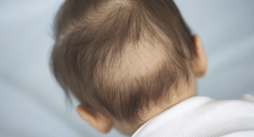 Understanding and Nurturing Baby Hair: A Comprehensive Guide for Parents