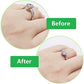 Importikaah-ring-adjusters-for-enhancing-ring-fit-three-included-in-pack