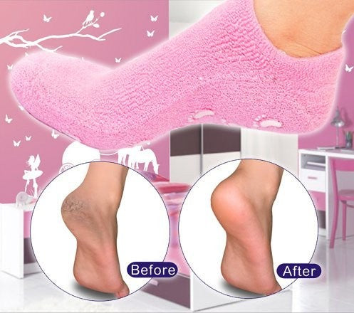 Importikah Moisturize Skin Repair Cracked Moisturizing Treatment Gel Spa Socks – Pair